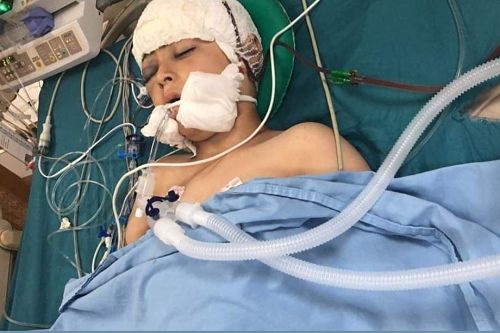 Plus de 100 fragments de balle dans le cerveau d'un enfant palestinien blessé dans le nord de la Cisjordanie